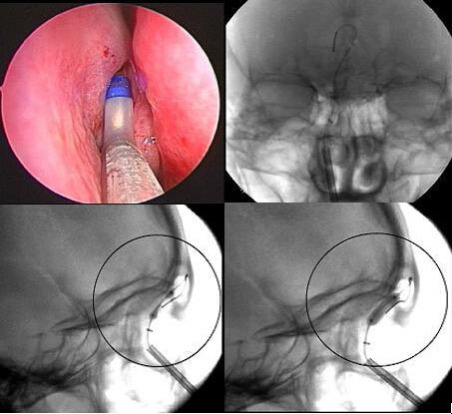 成都鼻炎医院排名哪家好 仁品鼻科全明星等您