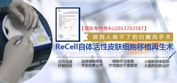 recell自体活性皮肤细胞移植再生术|解决大面积白癜风治疗难题@贵州