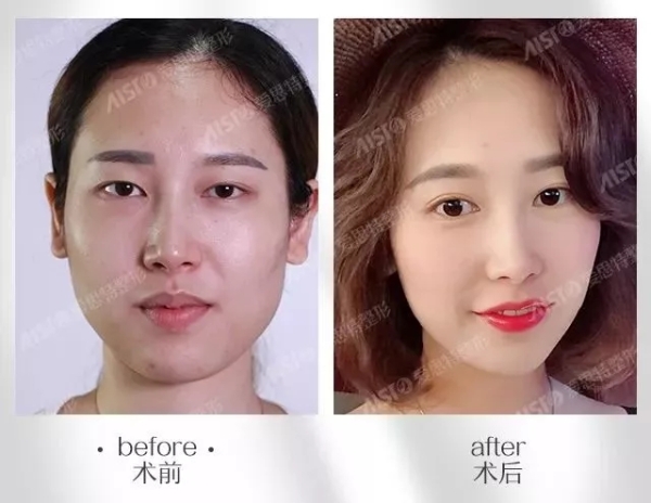 8.webp.jpg