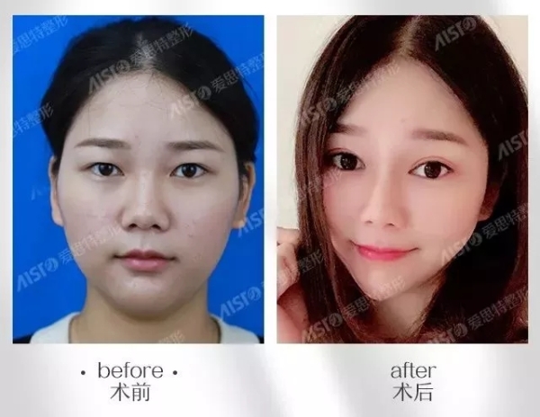 9.webp.jpg