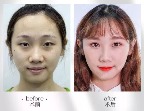 10.webp.jpg