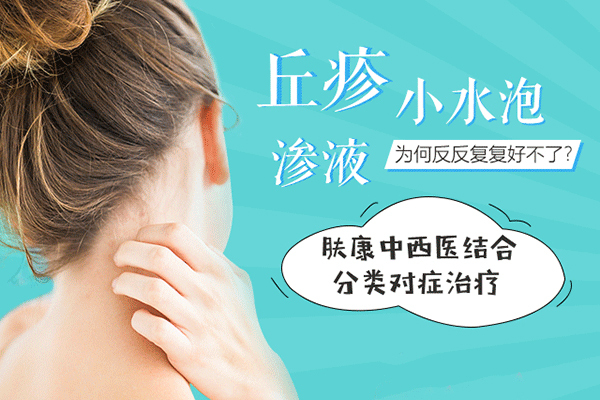 湿疹.jpg