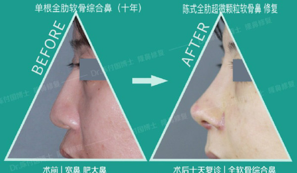 541760fdly1g758xvf7yaj21hc0x2jy1_meitu_5.jpg