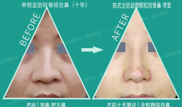 541760fdly1g758xuj982j21hc0x2qa7_meitu_8.jpg