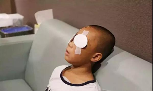 昆明眼科医院：在希玛做义眼手术将有机会“重见光明”