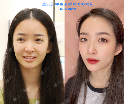#ʽ#ӵȻ촽ǡҸٲˣ