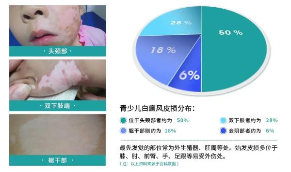 【爱满华夏·公益助学】“第三届华夏彩云行动·暑期公益祛白节”活动即将启动