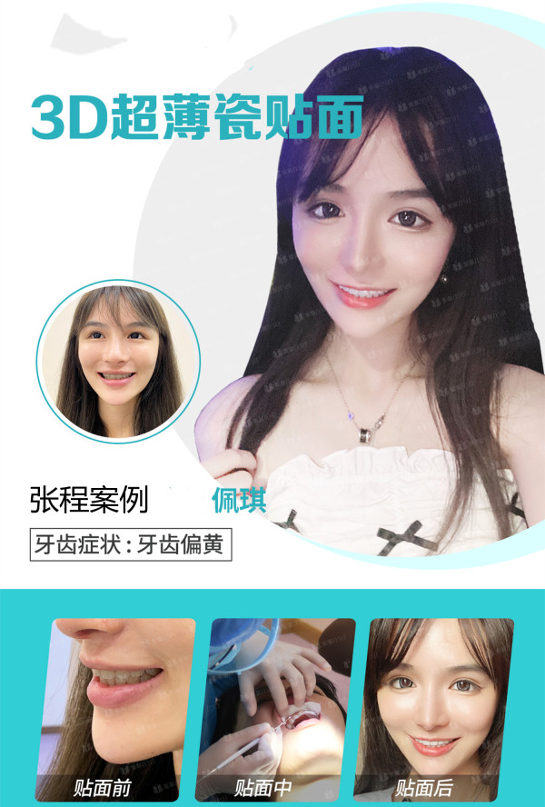 03.jpg
