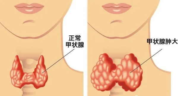 图片10.png 图片10.png