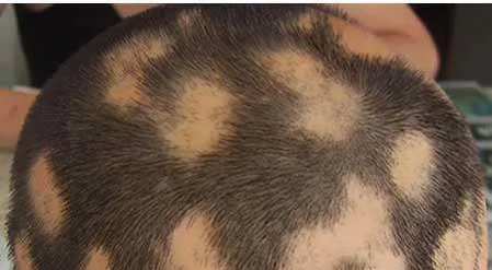 图片11.png 图片11.png